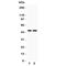 Znt4 antibody, R31313, NSJ Bioreagents, Western Blot image 