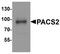 Phosphofurin Acidic Cluster Sorting Protein 2 antibody, A08193, Boster Biological Technology, Western Blot image 