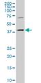 Cytidine/Uridine Monophosphate Kinase 2 antibody, H00129607-A01, Novus Biologicals, Western Blot image 