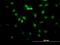 Retroviral integration site protein Fli-1 antibody, H00002313-M07, Novus Biologicals, Immunocytochemistry image 
