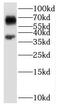 Chromosome 1 Open Reading Frame 116 antibody, FNab01060, FineTest, Western Blot image 