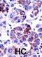 N-Myristoyltransferase 1 antibody, abx031614, Abbexa, Immunohistochemistry paraffin image 