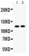 ATPase Sarcoplasmic/Endoplasmic Reticulum Ca2+ Transporting 2 antibody, PA5-78837, Invitrogen Antibodies, Western Blot image 