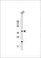 Chondroitin Sulfate N-Acetylgalactosaminyltransferase 2 antibody, GTX81034, GeneTex, Western Blot image 