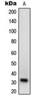 Neurexophilin 1 antibody, LS-C353423, Lifespan Biosciences, Western Blot image 