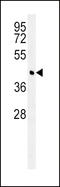Branched Chain Amino Acid Transaminase 1 antibody, LS-C156761, Lifespan Biosciences, Western Blot image 