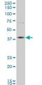 Homeobox D11 antibody, H00003237-M06, Novus Biologicals, Western Blot image 