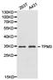 Tropomyosin alpha-3 chain antibody, TA326995, Origene, Western Blot image 