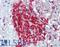 Nerve Growth Factor Receptor antibody, LS-B3440, Lifespan Biosciences, Immunohistochemistry paraffin image 