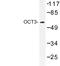 Solute Carrier Family 22 Member 3 antibody, LS-C177484, Lifespan Biosciences, Western Blot image 