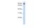 Transferrin Receptor 2 antibody, GTX46553, GeneTex, Western Blot image 