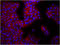 Integrin Subunit Beta 1 antibody, LS-C40964, Lifespan Biosciences, Immunohistochemistry paraffin image 