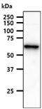 Acyl-CoA Synthetase Family Member 2 antibody, GTX57705, GeneTex, Western Blot image 