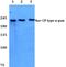 Sodium Voltage-Gated Channel Alpha Subunit 9 antibody, PA5-36543, Invitrogen Antibodies, Western Blot image 