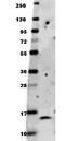 AKT Serine/Threonine Kinase 2 antibody, orb345014, Biorbyt, Western Blot image 