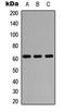 Pyruvate Dehyrogenase Phosphatase Catalytic Subunit 1 antibody, LS-C354451, Lifespan Biosciences, Western Blot image 