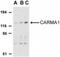 Caspase Recruitment Domain Family Member 11 antibody, NBP1-77219, Novus Biologicals, Western Blot image 