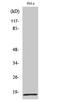 Mitochondrial Ribosomal Protein L20 antibody, A14230-1, Boster Biological Technology, Western Blot image 