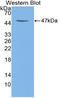 Colony Stimulating Factor 2 antibody, LS-C314355, Lifespan Biosciences, Western Blot image 