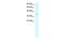 Fatty acid desaturase antibody, GTX77829, GeneTex, Western Blot image 