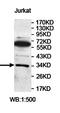 Phosphatidylinositol Transfer Protein Beta antibody, orb78132, Biorbyt, Western Blot image 