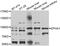 EPH Receptor A1 antibody, abx006448, Abbexa, Western Blot image 