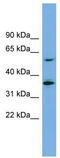 Y+L amino acid transporter 1 antibody, TA333985, Origene, Western Blot image 