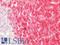 Isocitrate Dehydrogenase (NADP(+)) 1, Cytosolic antibody, LS-C663753, Lifespan Biosciences, Immunohistochemistry paraffin image 