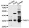 Troponin T1, Slow Skeletal Type antibody, abx126724, Abbexa, Western Blot image 