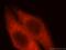 Hydroxymethylglutaryl-CoA synthase, cytoplasmic antibody, 17643-1-AP, Proteintech Group, Immunofluorescence image 