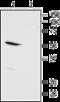 Potassium Two Pore Domain Channel Subfamily K Member 13 antibody, GTX16693, GeneTex, Western Blot image 