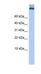 Coatomer Protein Complex Subunit Alpha antibody, NBP1-59298, Novus Biologicals, Western Blot image 