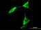 Aldehyde Dehydrogenase 1 Family Member L1 antibody, H00010840-M01, Novus Biologicals, Immunofluorescence image 