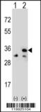 Voltage Dependent Anion Channel 1 antibody, 62-367, ProSci, Western Blot image 