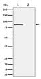 RAD17 Checkpoint Clamp Loader Component antibody, P02159-1, Boster Biological Technology, Western Blot image 