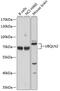 Ubiquilin 2 antibody, GTX64773, GeneTex, Western Blot image 