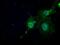 N-Acetyltransferase 8 (Putative) antibody, GTX84063, GeneTex, Immunofluorescence image 
