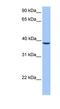 Sad1 And UNC84 Domain Containing 3 antibody, NBP1-55413, Novus Biologicals, Western Blot image 