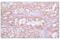 DEK Proto-Oncogene antibody, 29812S, Cell Signaling Technology, Immunohistochemistry paraffin image 