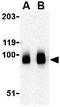 BR Serine/Threonine Kinase 1 antibody, GTX85055, GeneTex, Western Blot image 