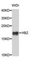 Hemoglobin Subunit Zeta antibody, STJ23920, St John