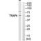 TNF Receptor Associated Factor 4 antibody, PA5-50176, Invitrogen Antibodies, Western Blot image 