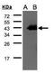 Cyclin-D1-binding protein 1 antibody, GTX106440, GeneTex, Western Blot image 