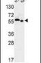 Solute Carrier Family 47 Member 2 antibody, PA5-24659, Invitrogen Antibodies, Western Blot image 