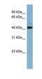 NAD Kinase 2, Mitochondrial antibody, orb325824, Biorbyt, Western Blot image 