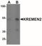 Kringle Containing Transmembrane Protein 2 antibody, NBP2-22339, Novus Biologicals, Western Blot image 