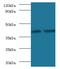 Glycosyltransferase 8 Domain Containing 2 antibody, MBS1490556, MyBioSource, Western Blot image 