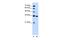 Solute Carrier Family 25 Member 29 antibody, PA5-42417, Invitrogen Antibodies, Western Blot image 