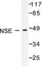 Enolase 2 antibody, LS-C176147, Lifespan Biosciences, Western Blot image 