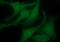 Platelet Derived Growth Factor Receptor Beta antibody, M00096-3, Boster Biological Technology, Immunofluorescence image 